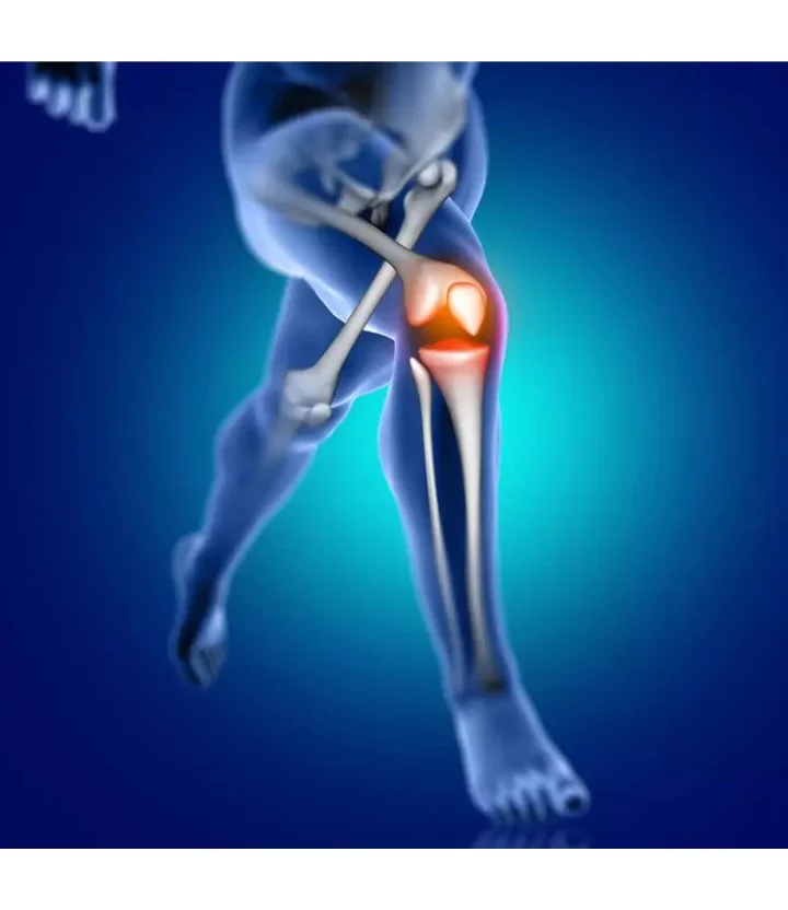 Como funciona a Artroplastia de joelho e quadril? Imagem: Freepik