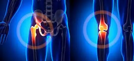 Temperaturas baixas e a dor de pessoas com osteoartrite